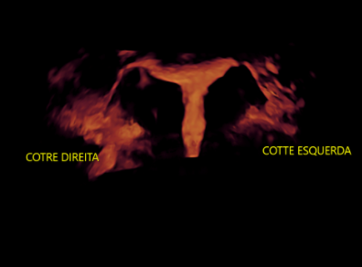 1- 2 - COTTES