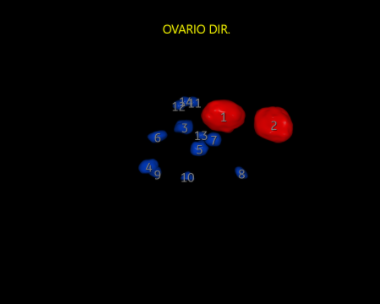 4 - 5 - OVÁRIO